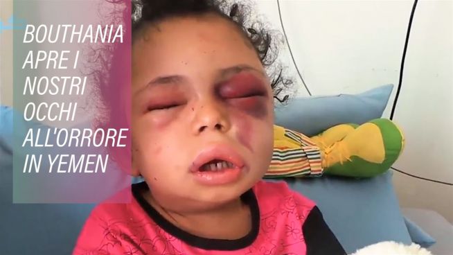 Questa bimba apre i nostri occhi sul conflitto in Yemen