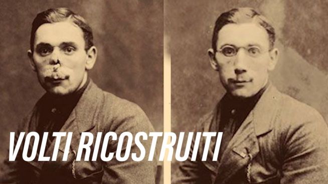 Prima Guerra Mondiale: l'artista dei volti ricostruiti